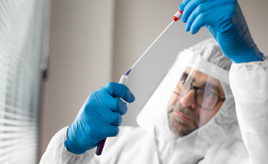 PCR Swab